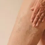 can-you-reverse-crepey-skin?-look-for-these-ingredients