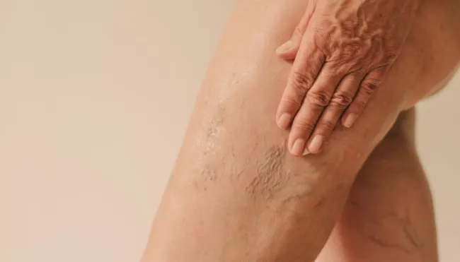 can-you-reverse-crepey-skin?-look-for-these-ingredients