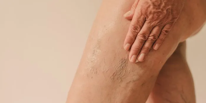 can-you-reverse-crepey-skin?-look-for-these-ingredients