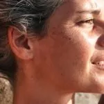 this-oft-overlooked-sign-may-help-diagnose-skin-cancer,-study-finds