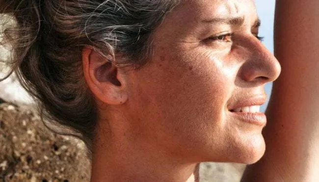 this-oft-overlooked-sign-may-help-diagnose-skin-cancer,-study-finds